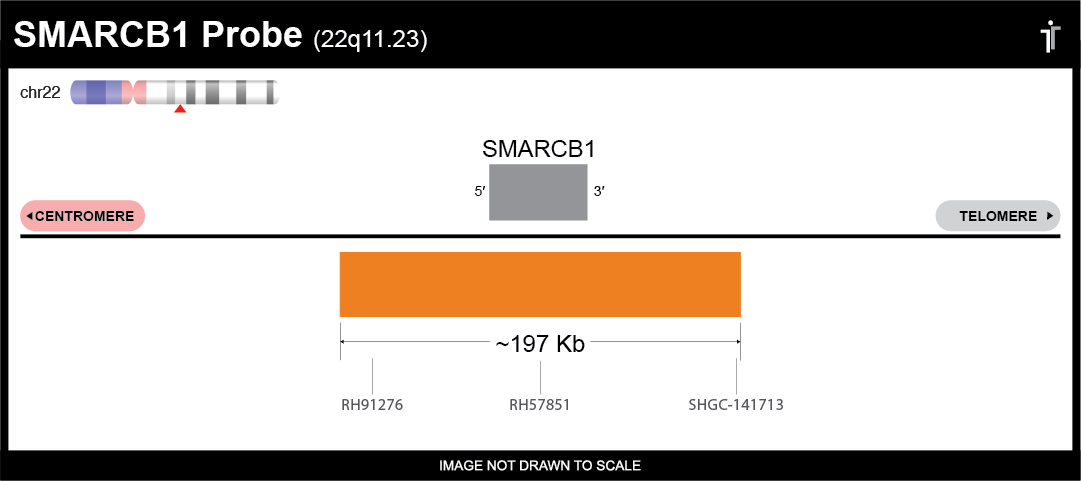 SMARCB1 FISH Probe Ideogram